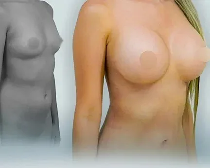 Img-cirujano-plastico-Servicios-Mamoplastia-de-aumento-Fondo